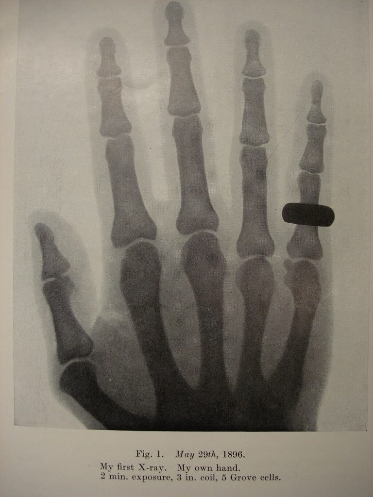 Pirmā rentgenogramma - radiologs