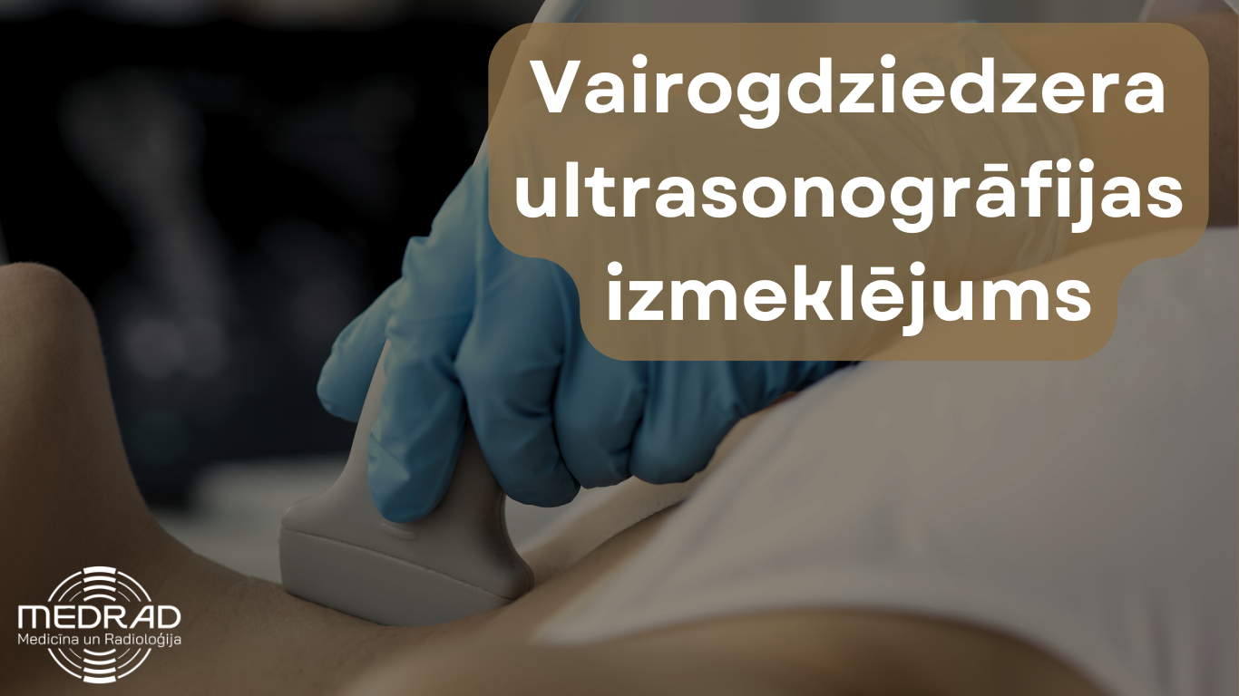 Vairogdziedzera ultrasonogrāfija