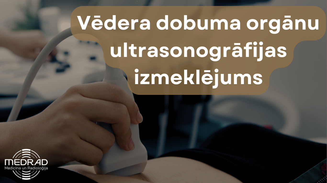 vēdera dobuma ultrasonogrāfija