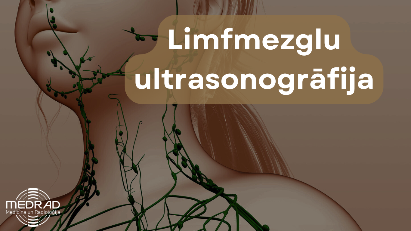 Shematisks attēls, kurā redzami kakla limfmezgli, limfmezglu ultrasonogrāfijai.