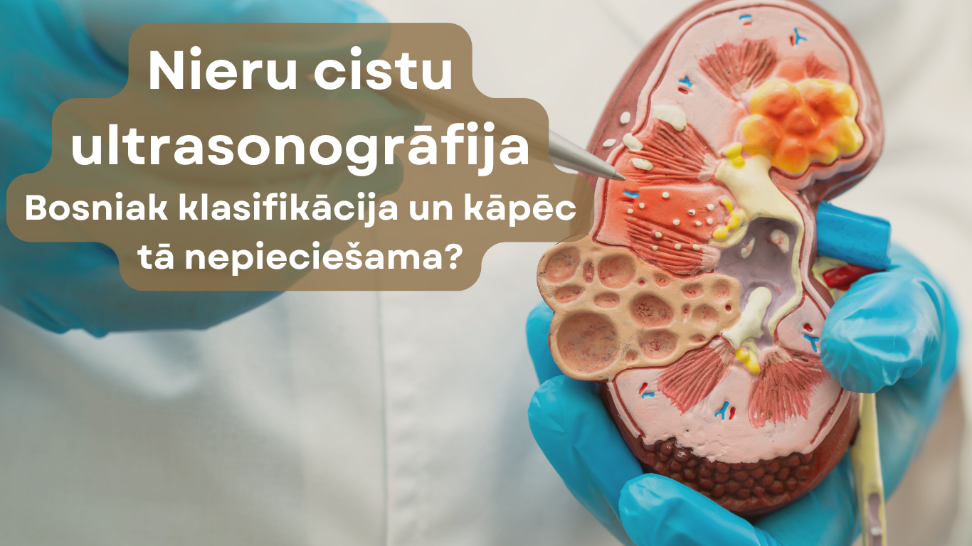 Kāpēc nepieciešama nieru cistu ultrasonogrāfija? – Bosniak 2019 klasifikācija