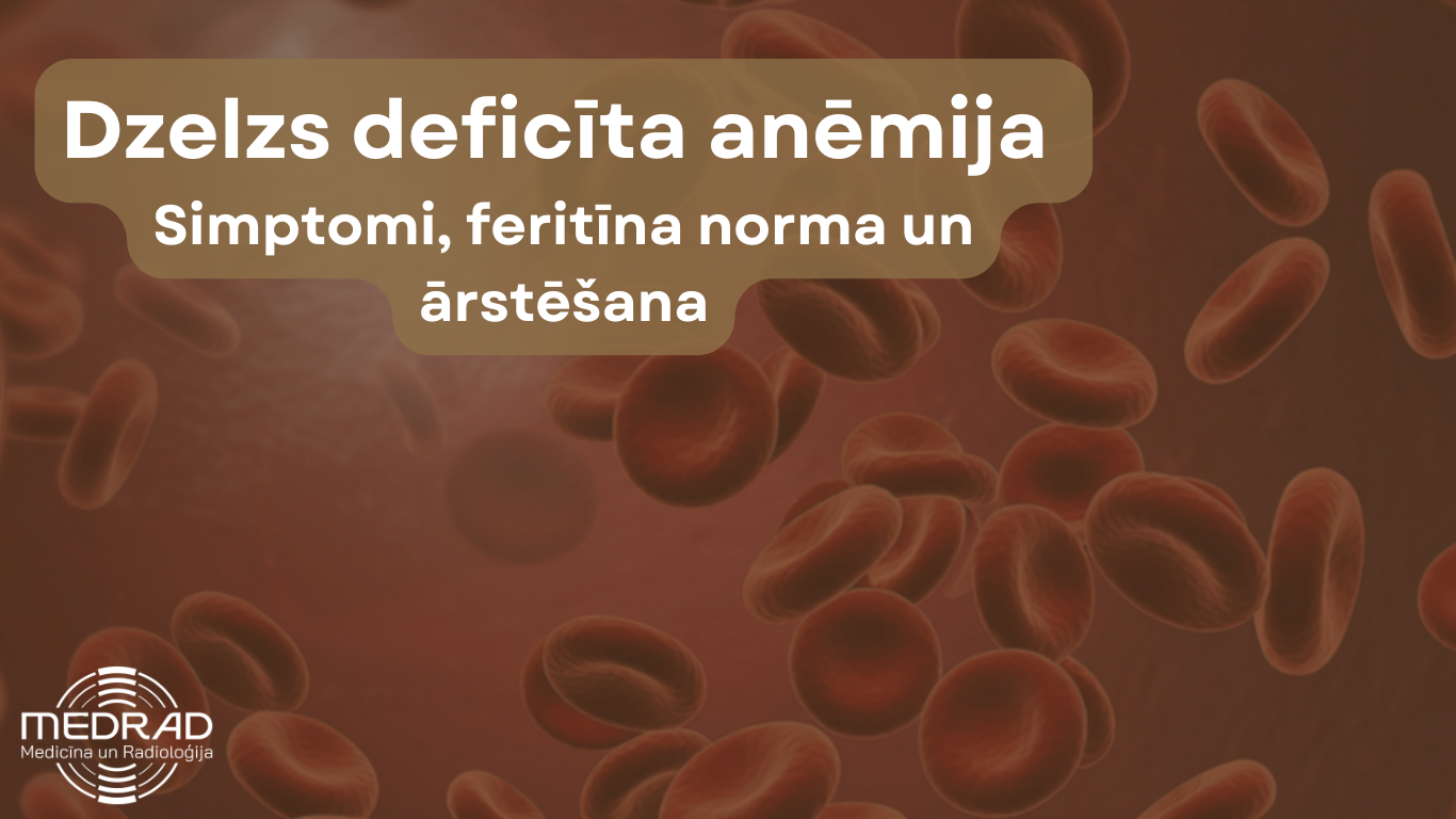 Dzelzs deficita anemija